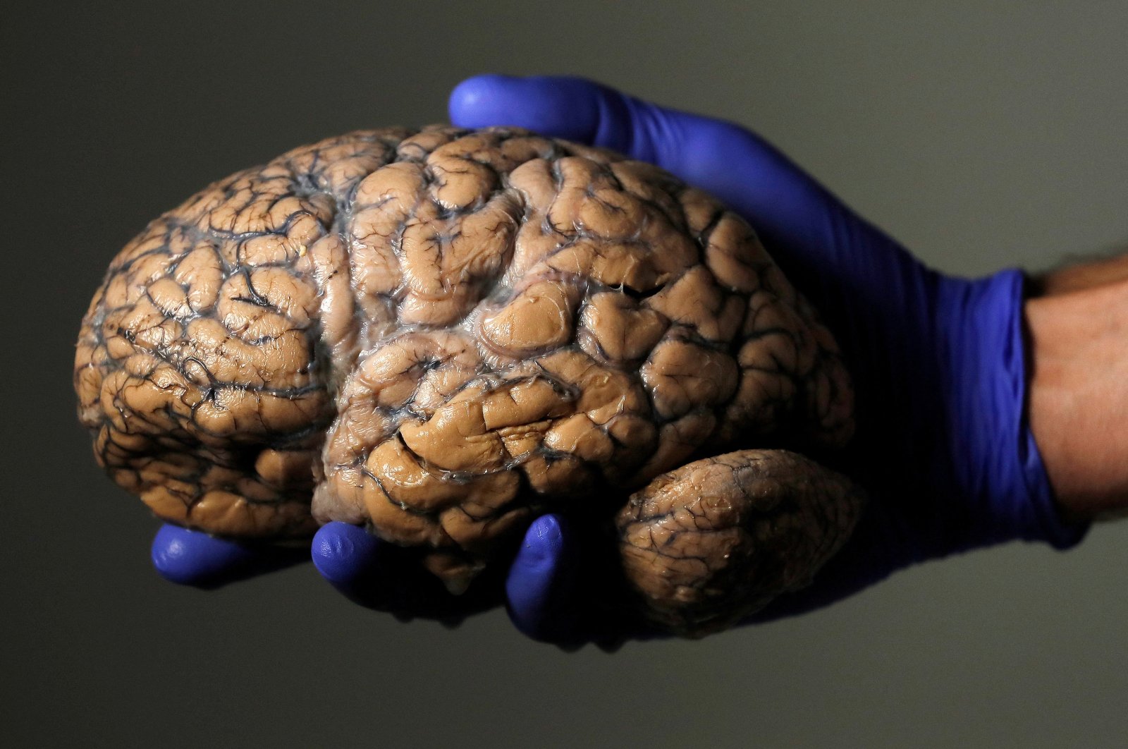 Does adolescence last until 32? Scientists unlock brain’s five eras